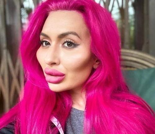 国外整容网红,揭秘国外整形网红的美丽蜕变之路